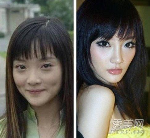 明星爆料整容视频大全下载,视频大全下载解析 第3张 明星爆料整容视频大全下载,视频大全下载解析 第3张